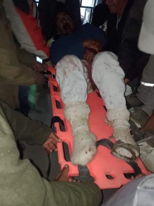  Delincuentes asesinan a mujer y dejan herido a su esposo en Pamparomás