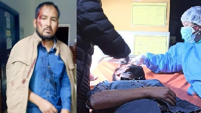 Áncash: Agreden brutalmente a candidato a la alcaldía del distrito de Ponto en Huari