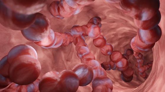 Bacteria letal común se propaga en EEUU: expertos alertan sobre una pandemia silenciosa  