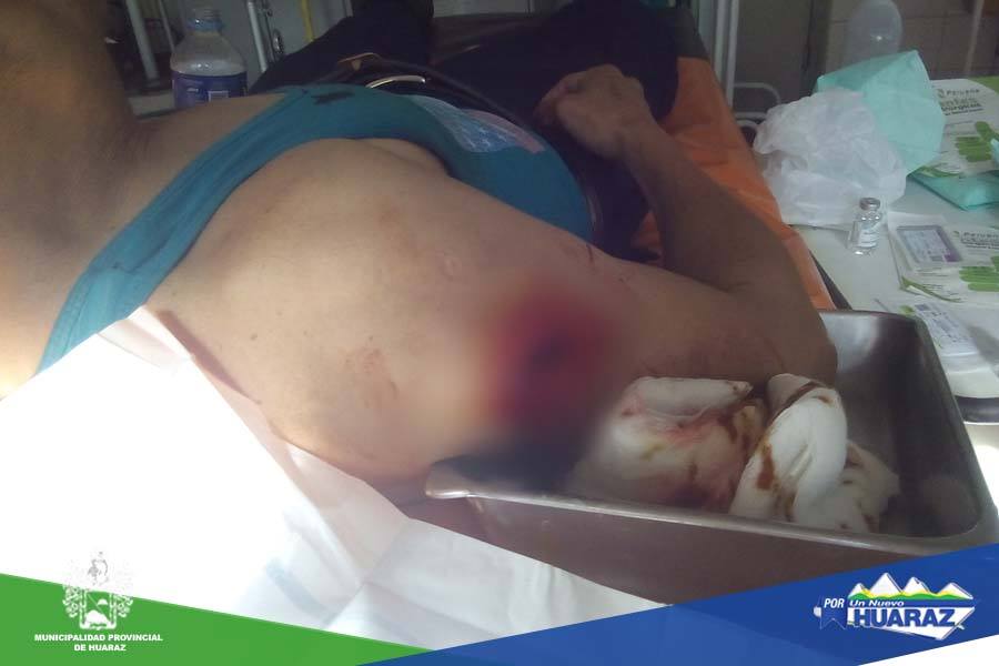 Policía municipal es acuchillado por comerciante