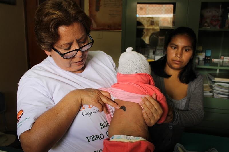 Realizan despistaje de cáncer de piel por el Día del Lunar en Huaraz y Carhuaz