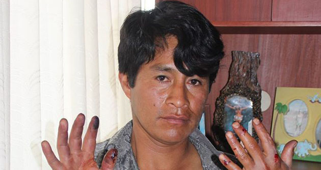 Denuncian agresión a comerciante por parte de policías municipales