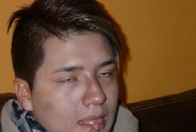 Estilista denunció a funcionario de la Dires Áncash por agresión