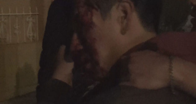 Maleantes desfiguran el rostro a parroquiano en plena Plaza de Armas