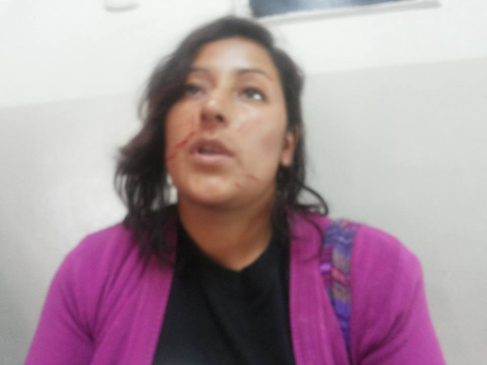 Regidora de Independencia es denunciada por agresión física