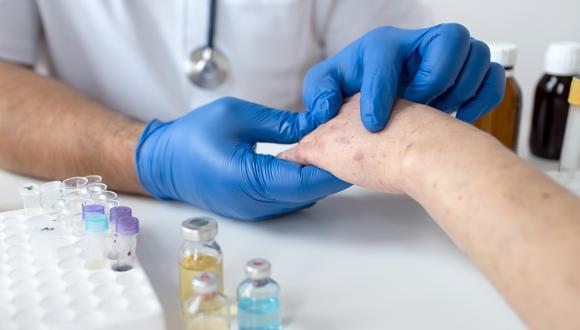 MEF transfiere más de S/ 27 millones para enfrentar brotes de poliomielitis y sarampión