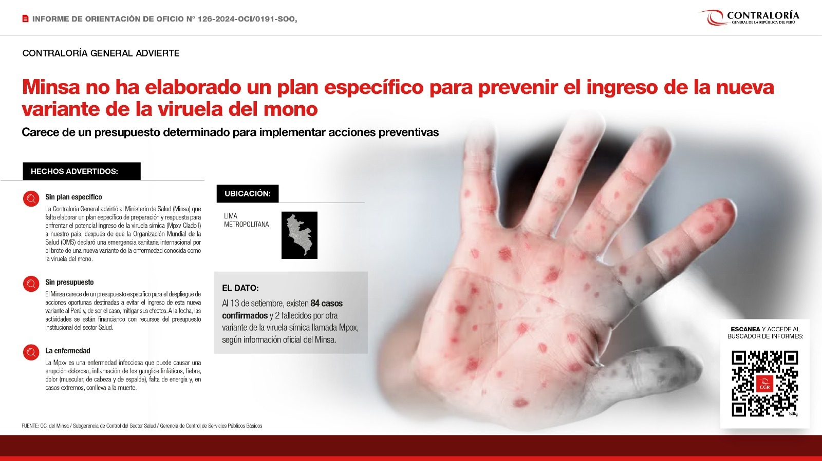 Minsa no ha elaborado un plan específico ante alerta epidemiológica para prevenir acceso de la nueva viruela del mono