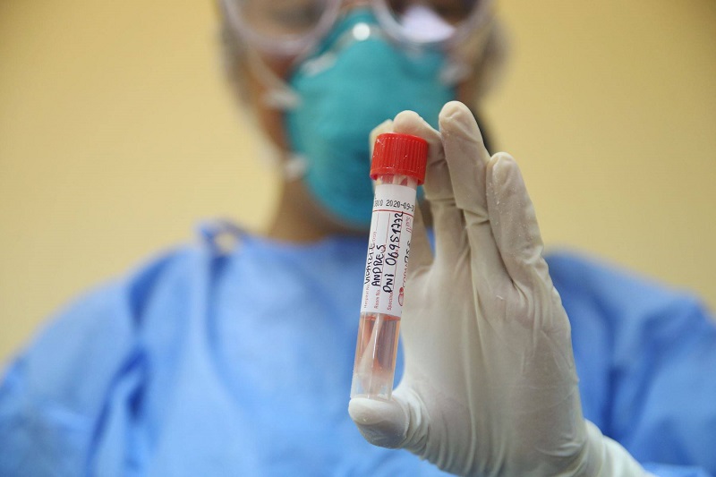 Minsa procesó 107 muestras y todas tienen resultado negativo para Coronavirus