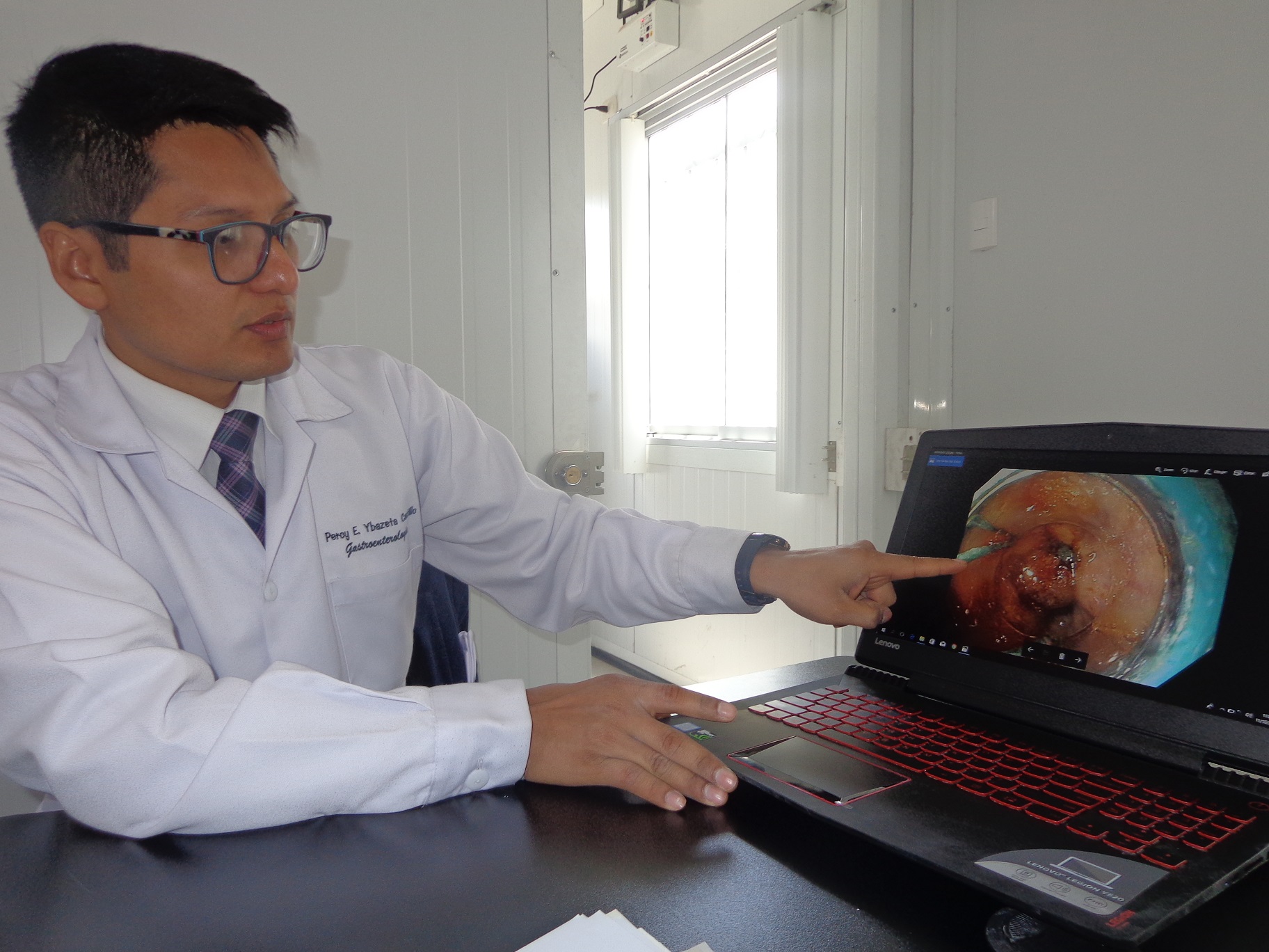 Huaraz: realizan ligaduras de várices esofágicas en hospital Victor Ramos Guardia