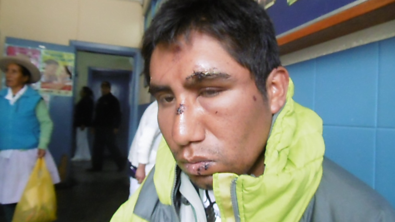 Maleantes dejan mal herido a guía de montaña en Independencia