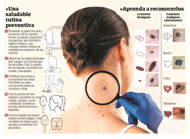 Debemos estar alerta ante lunares que aparecen de manera repentina