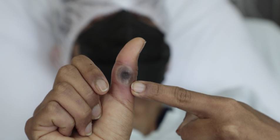 Diresa Áncash reporta tres casos sospechosos de viruela del mono    